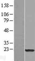 SPA17 / Sperm Protein 17 (Over-Expression Lysate Myc-DDK (Flag))