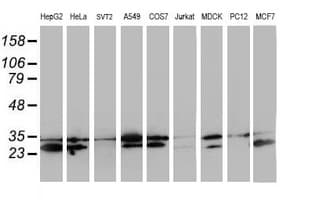 HDHD1 Antibody (clone OTI7A2)
