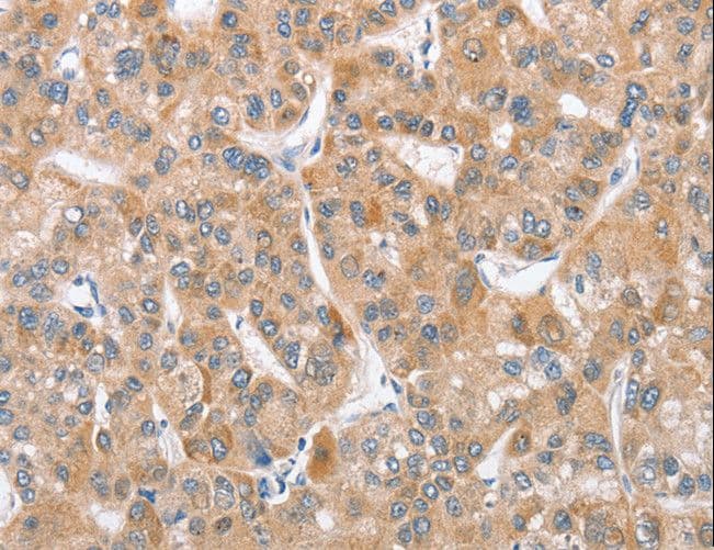 APG12 / ATG12 Antibody