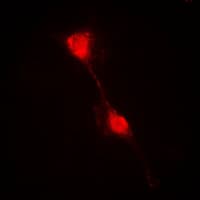 Polyclonal Rabbit anti-Human NFKBIA / IKB Alpha / IKBA Antibody (N-Terminus, IHC, IF, WB)