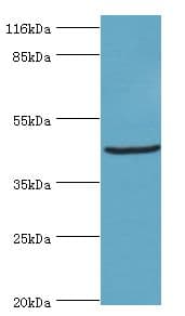 STRADB / ALS2CR2 Antibody
