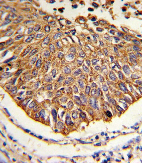 Polyclonal Rabbit anti-Human MDH / MDH2 Antibody (aa86-115, IHC, WB)