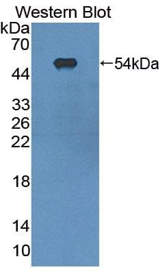 ITGAX / CD11c Antibody (aa907-1115, PE)