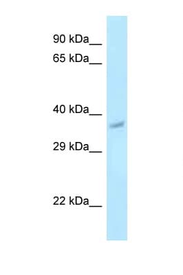 PNCK / CaMK1b Antibody (aa191-240)