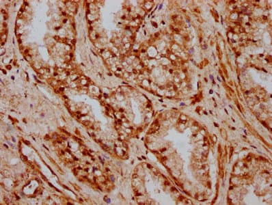 Polyclonal Rabbit anti-Human HOXB3 Antibody (IHC)