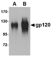 HIV-1 gp120 Antibody