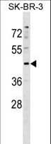 STK24 / MST3 Antibody (aa222-249)
