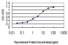 PITX2 / RGS Antibody (clone 2G6)