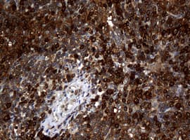 NME1 / NM23 Antibody (clone OTI7F6)