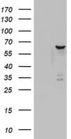 Monoclonal Mouse anti-Human DDX56 Antibody (clone OTI6E8, aa323-547, IHC, WB)
