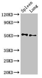 PSEN2 / Presenilin 2 Antibody
