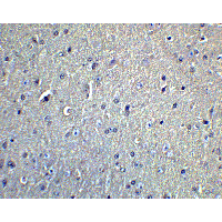 Polyclonal Rabbit anti-Human DCLK / DCLK1 Antibody (IHC, IF, WB)