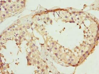 HPTPB / PTPRB Antibody