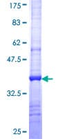 Human SLC6A5 / GLYT2 Protein (Recombinant GST, N-terminus)