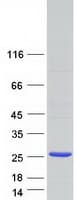 Human RPP25 Protein (Recombinant Myc-DDK (Flag))