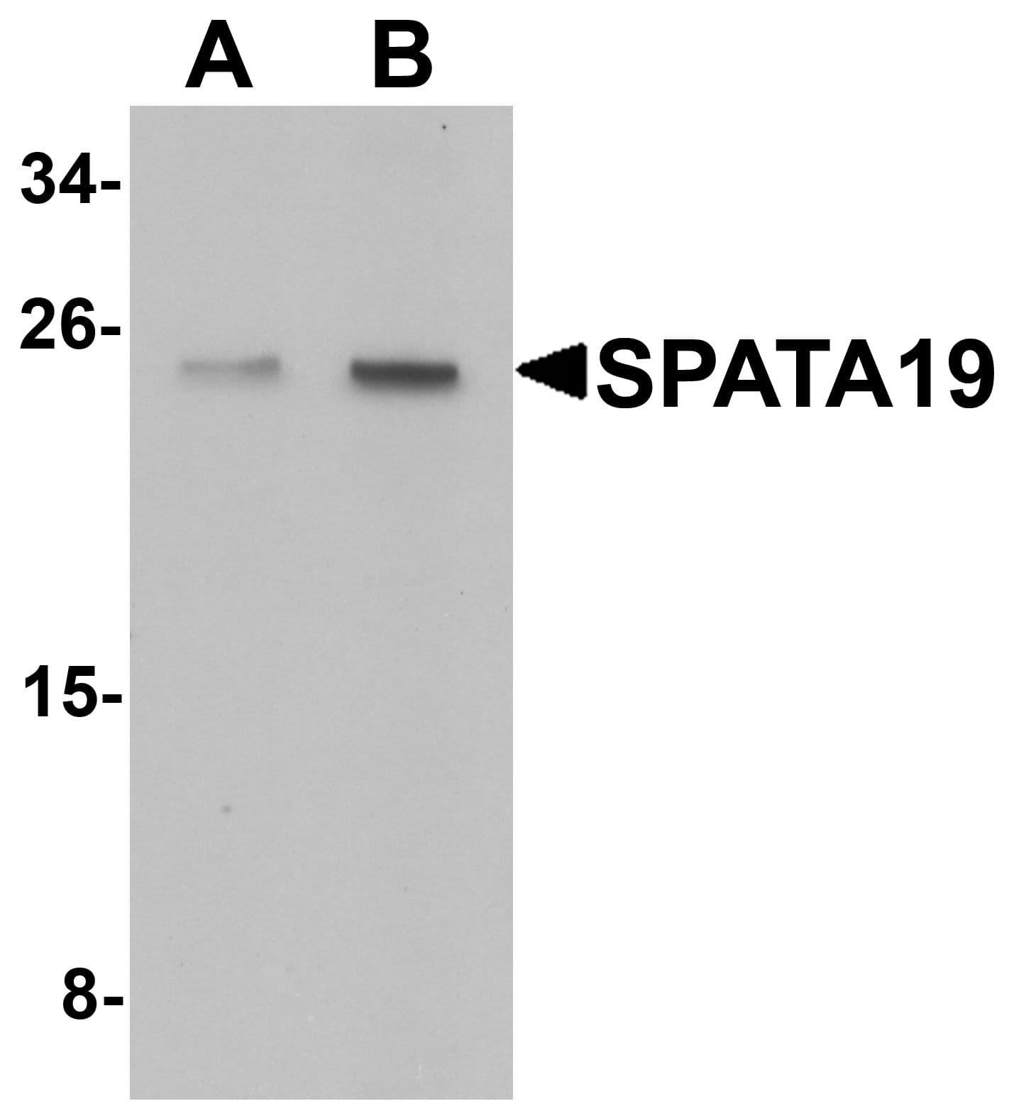 IHC-plus™ Polyclonal Chicken anti-Human SPATA19 Antibody (IHC, WB)