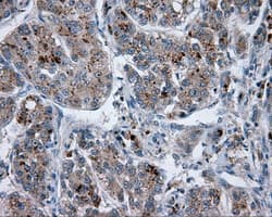 LIPG / Endothelial Lipase Antibody (clone OTI1D9, Carrier-free)