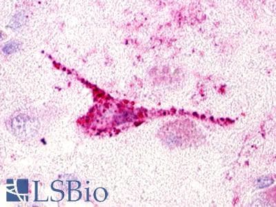 PathPlus™ Polyclonal Rabbit anti-Human GPR20 Antibody (C-Terminus, IHC)