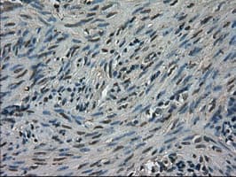 TRIB2 Antibody (clone OTI8D11)