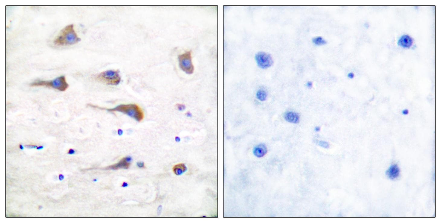 Polyclonal Rabbit anti-Human GRIK2 / GLUR6 Antibody (IHC, WB)