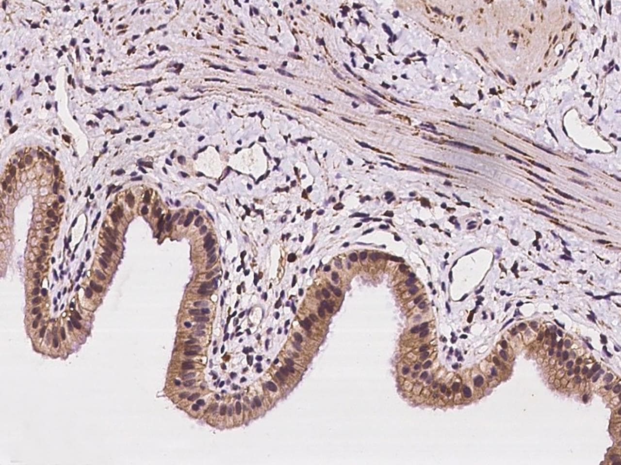 TMIGD2 Antibody