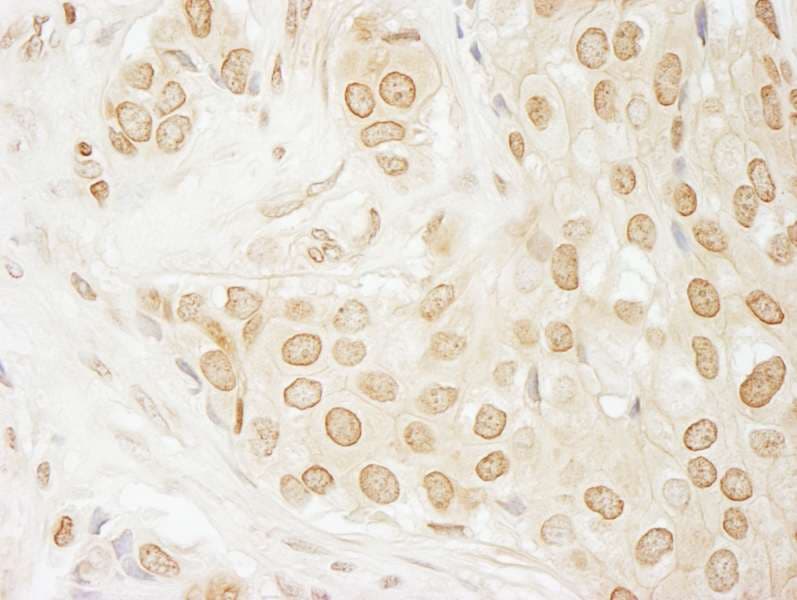 Polyclonal Rabbit anti-Human USP33 / VDU1 Antibody (aa425-475, IHC)