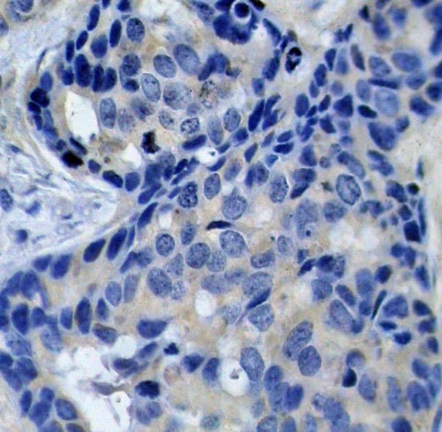 Polyclonal Rabbit anti-Human PTK2B / PYK2 Antibody (phospho-Tyr402, IHC, IF, WB)