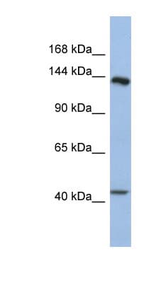 SLIT1 Antibody (aa1439-1488)