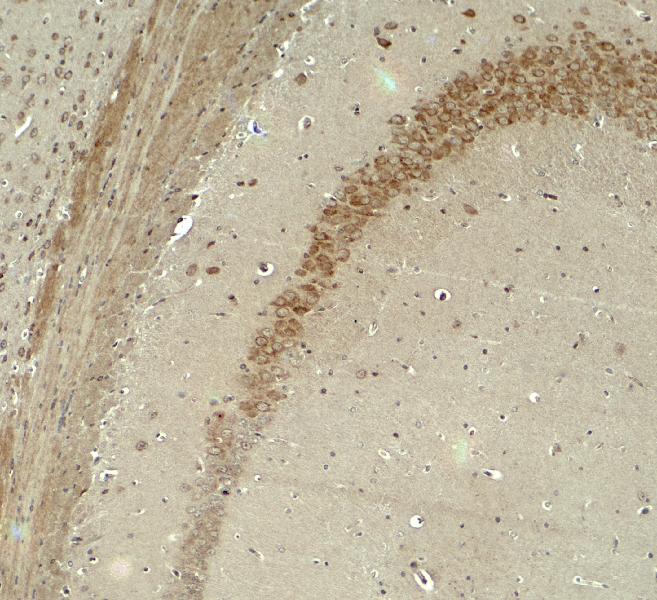 Polyclonal Rabbit anti-Human IQSEC2 Antibody (IHC, WB)