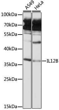 IL12B / IL12 p40 Antibody