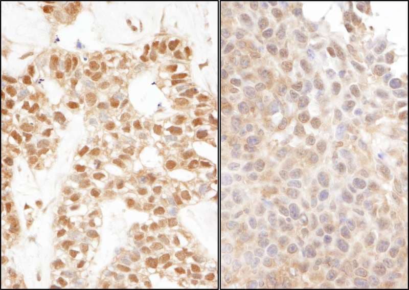 Polyclonal Rabbit anti-Human UBA52 Antibody (aa1-50, IHC, WB)