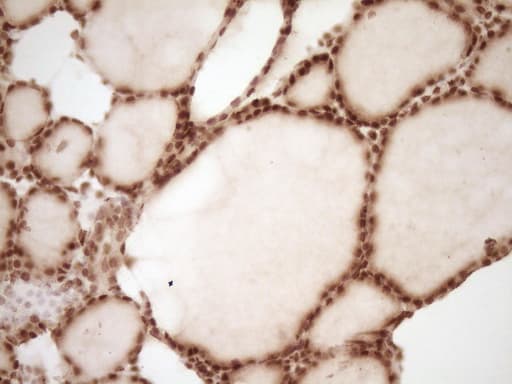 NUDT21 Antibody (aa2-227, clone OTI5B3)