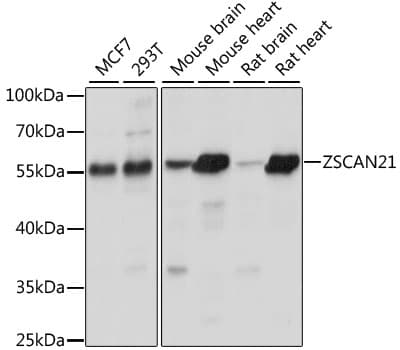 ZSCAN21 / Zipro1 Antibody