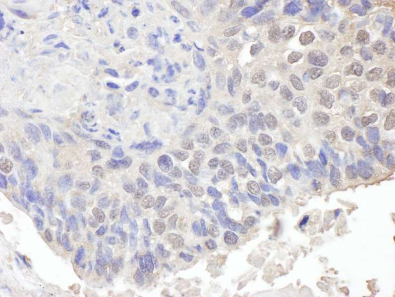 CHD8 Antibody (aa325-350)