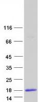 Human CRIP1 Protein (Recombinant Myc-DDK (Flag))