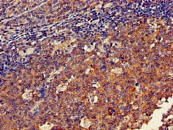 Polyclonal Rabbit anti-Human DOK3 Antibody (IHC, IF, WB)