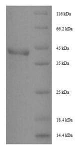 Dermatophagoides pteronyssinus DERP1 Protein (Recombinant 6His-SUMO, N-terminus)