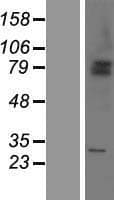 SHKBP1 Protein (Over-Expression Lysate Myc-DDK (Flag))