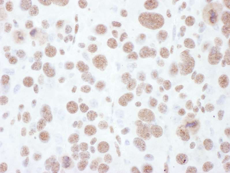 Polyclonal Rabbit anti-Human MAP2K1 / MKK1 / MEK1 Antibody (phospho-Thr286, IHC)