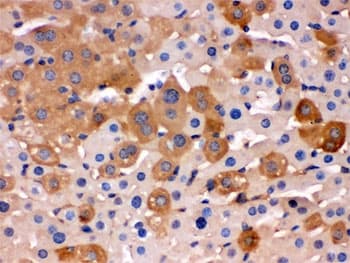 TF / Transferrin Antibody