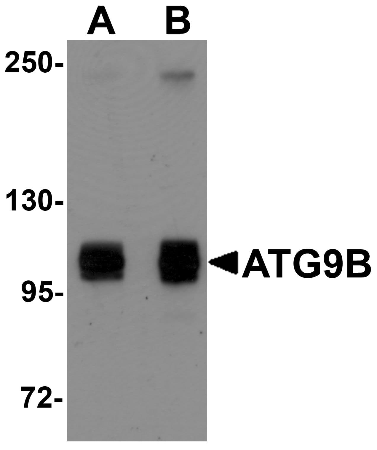 IHC-plus™ Polyclonal Rabbit anti-Human ATG9B Antibody (IHC, IF, WB)