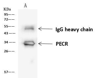 Polyclonal Rabbit anti-Human PECR Antibody (IHC, IF, WB)