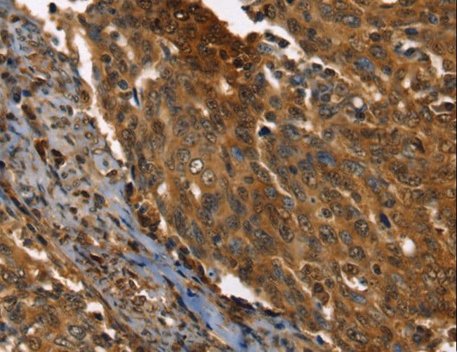 Polyclonal Rabbit anti-Human PPIA / Cyclophilin A Antibody (IHC, WB)