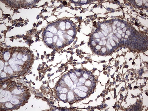 IL1RN Antibody (clone OTI2B1)