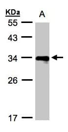 HLA-DR Beta Antibody (aa1-266)