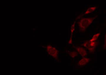 ACER2 Antibody