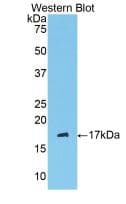SERPING1 / C1 Inhibitor Antibody (aa397-495)