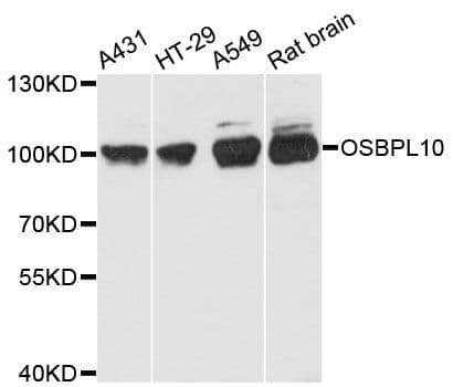 OSBPL10 Antibody