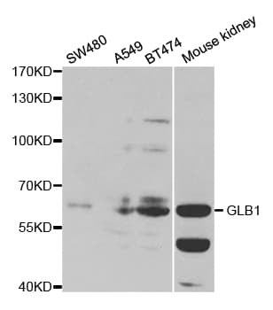 GLB1 / Beta-Galactosidase Antibody