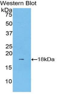 LCAT Antibody (aa290-433)